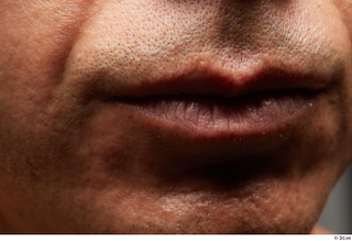 HD Face Skin Abel Alvarado chin face lips mouth skin…